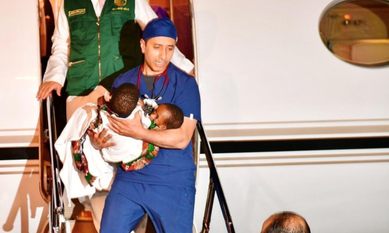 Tanzanian Conjoined Twins Arrive in KSA for Medical Treatment