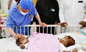 Nigerian conjoined twins, King Abdullah Specialist Children's Hospital, King Abdulaziz Medical City, Riyadh, King Salman bin Abdulaziz, Mohammed bin Salman