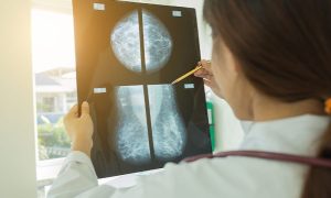 Study Identifies New Breast Cancer Genes in Women of African Ancestry
