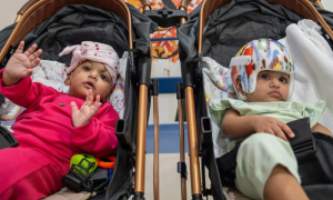 Turkiye, Surgeons, Conjoined, Pakistani Twins, 14-Hour Operation